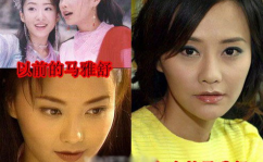 明星整形前后对比照,颜值蜕变还是面目全非？