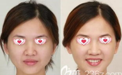 博美整形,专业美容与整形服务，塑造美丽新篇章